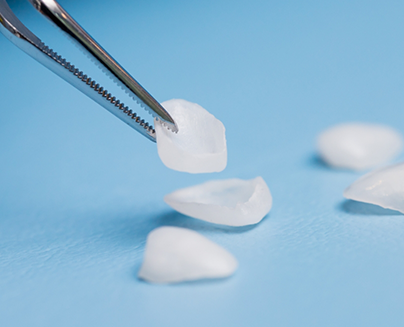 Picking up dental restorations with metal instrument