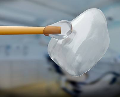 a close-up of a dental veneer