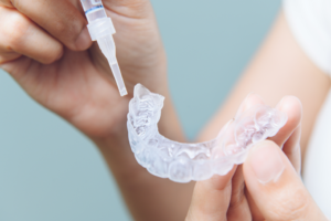 a woman putting whitening gel in a pair of dental trays